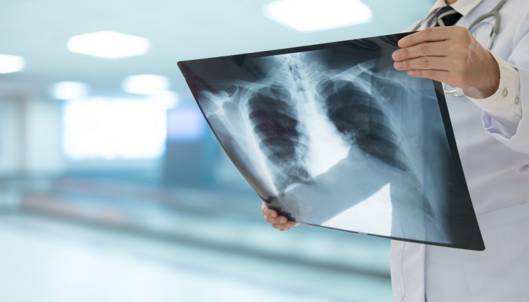 Lei cria Setembro Roxo para conscientizar sobre a fibrose cística